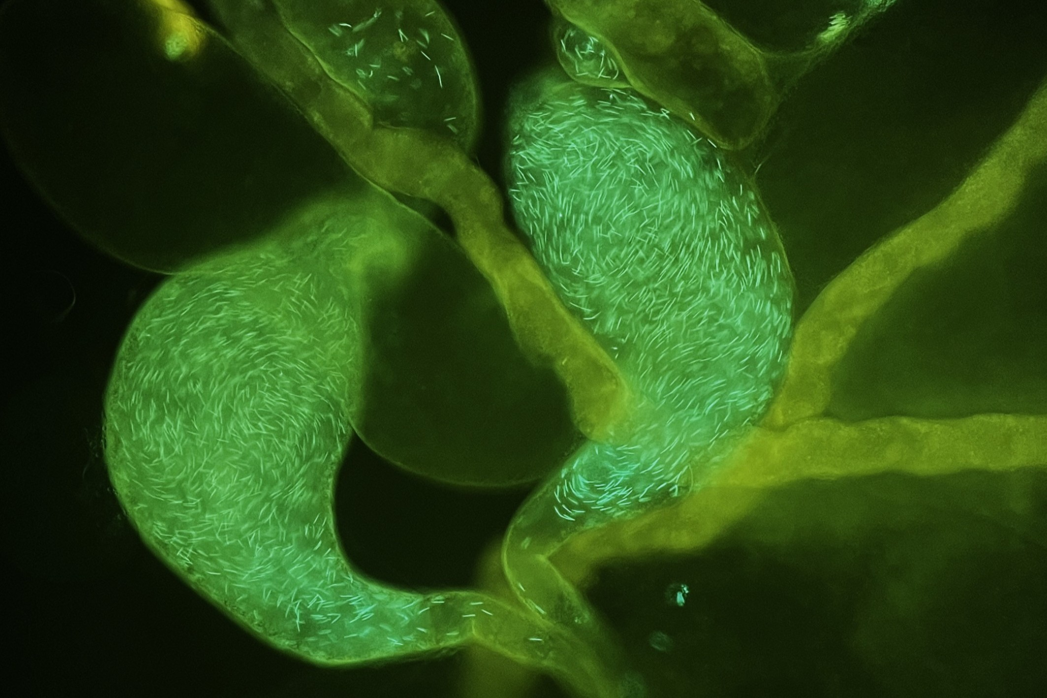 Fluorescence image of sperm in testes and seminal vesicles of male fruit fly.